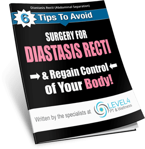 Diastasis Recti Report